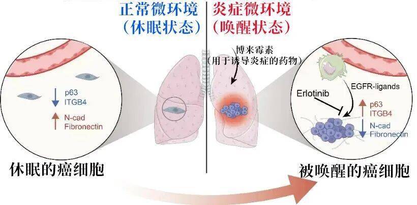 长期炎症会“唤醒”癌细胞<strong></p>
<p>比特币最高价格是多少</strong>！这份抗炎指南每个人都该看看