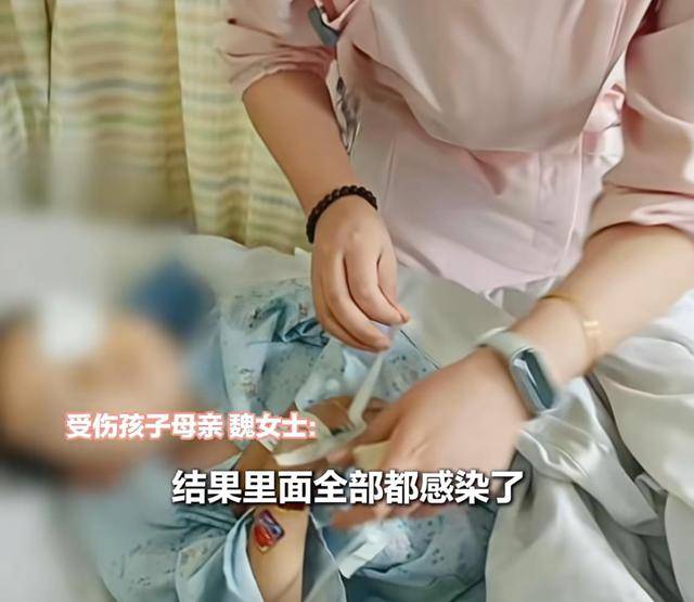 江西一5岁男孩在幼儿园被戳伤致左眼失明<strong></p>
<p>比特儿交易所</strong>，家长称老师用猪油涂抹试图消肿