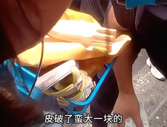 看着都疼<strong></p>
<p>比特儿海外</strong>！上海街头一男子突然求助：10岁女儿被死死卡住！这个行为太危险→