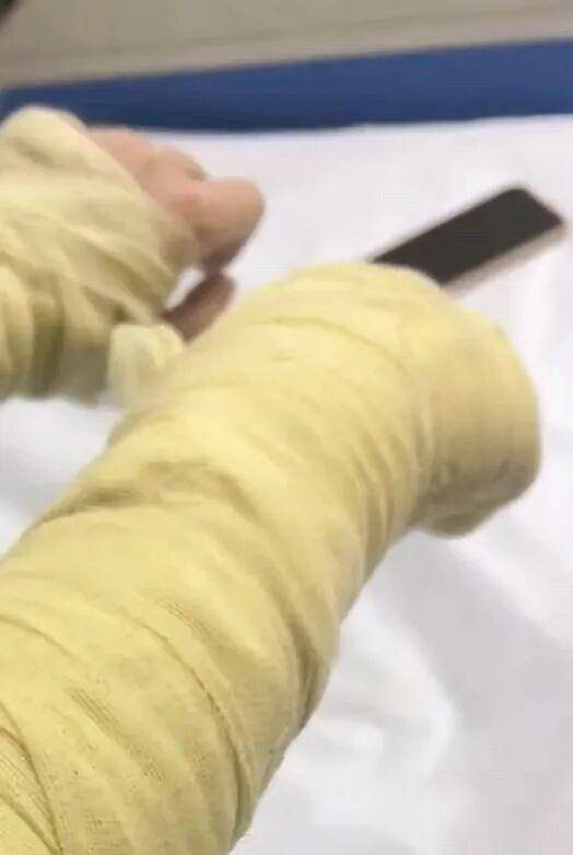 湖南一女主播被伪装的包裹炸伤<strong></p>
<p>比特儿海外</strong>，永州公安：正在核实具体情况