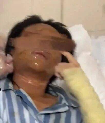 湖南一女主播被伪装的包裹炸伤<strong></p>
<p>比特儿海外</strong>，永州公安：正在核实具体情况