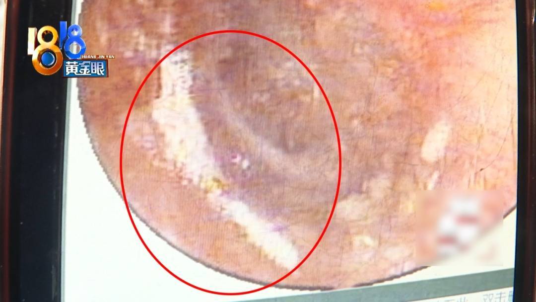 杭州姑娘痒了一整夜<strong></p>
<p>虚拟网领币</strong>，检查结果让她崩溃……浴场回应索赔：凭什么要两千？