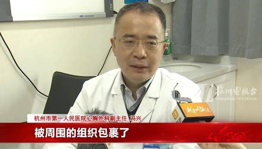 17岁小伙参军体检发现胸腔内有根5cm缝衣针<strong></p>
<p>中国出虚拟币</strong>，父母回忆或是1岁时扎入，取出时已锈迹斑斑